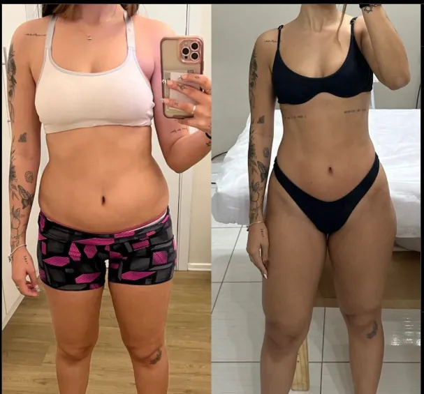 Antes y Después
