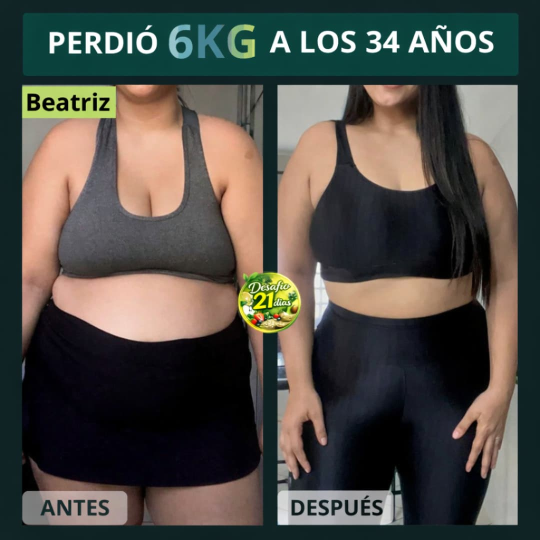 Antes y Después 1