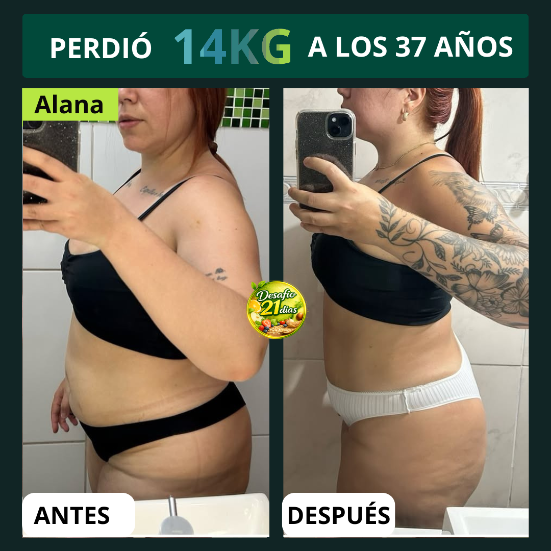 Antes y Después 2