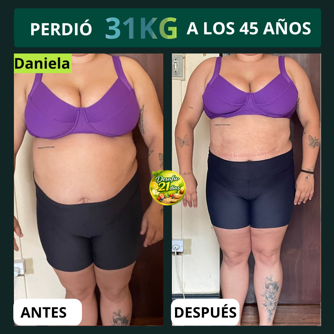 Antes y Después 3