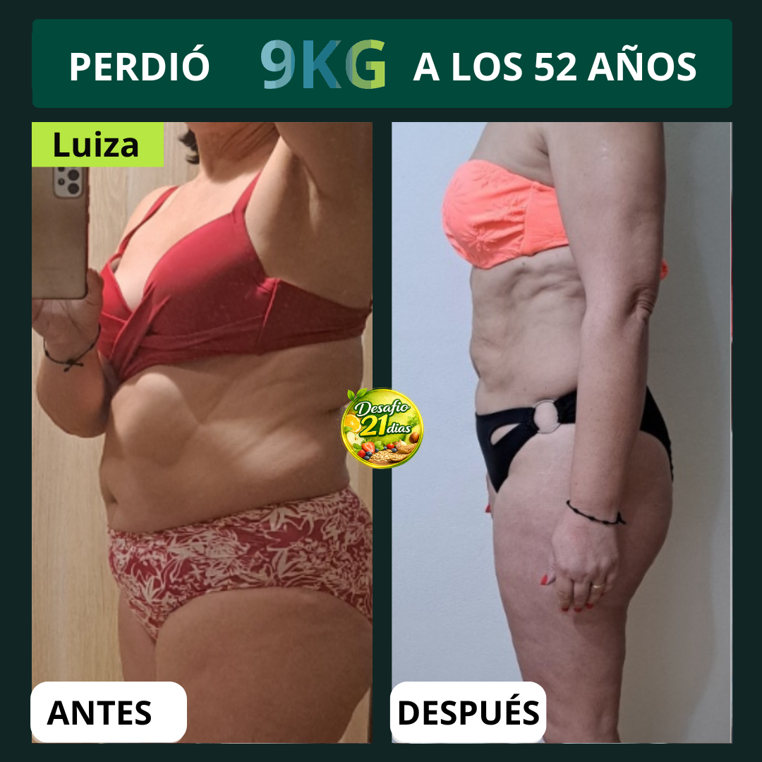 Antes y Después 4